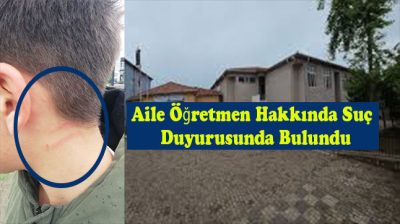 Akçakoca’da Bir İlköğretim Okulunda Şiddet İddiası: 13 Yaşındaki Öğrenci Darp Edildi
